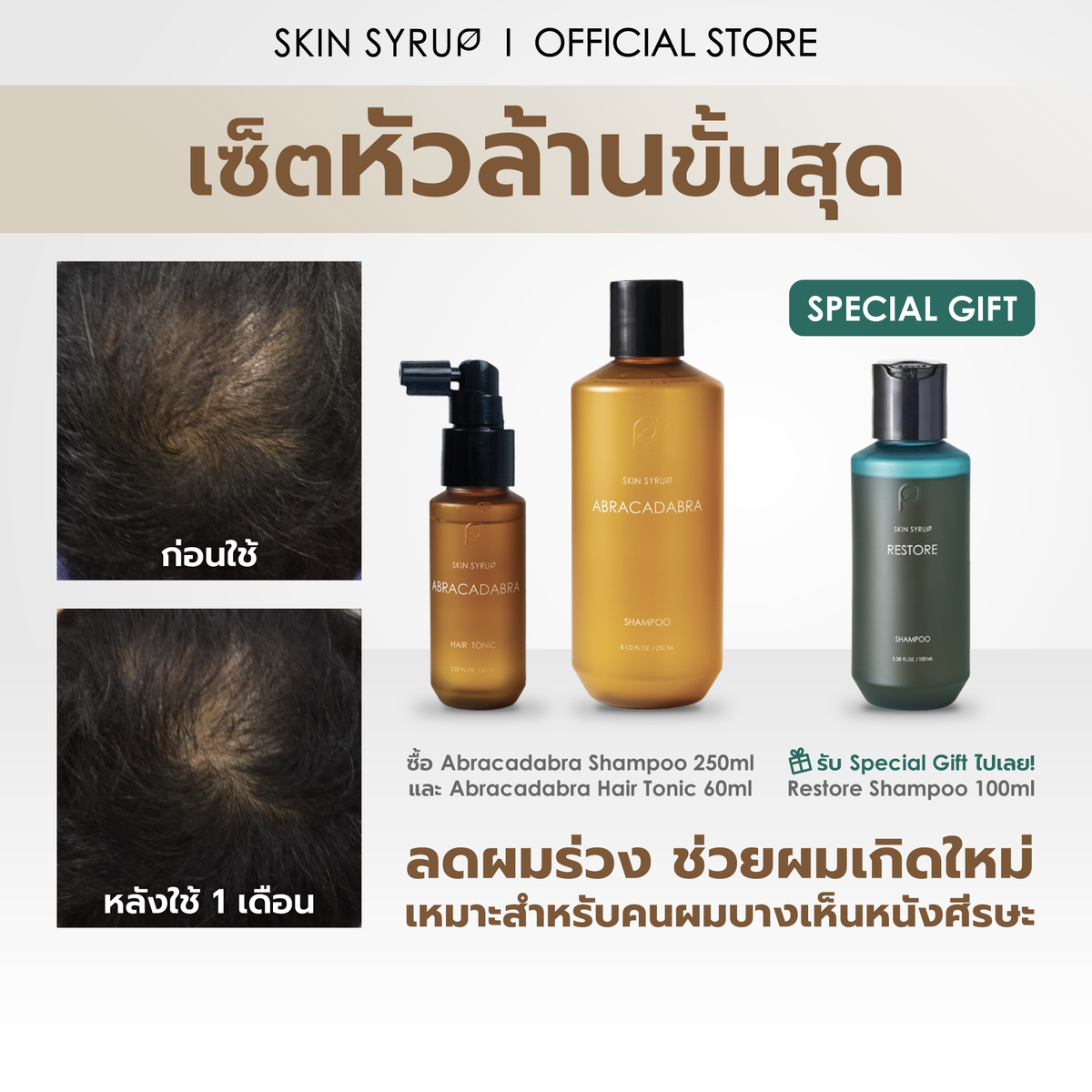 [NICKY] เซ็ตหัวล้านขั้นสุด