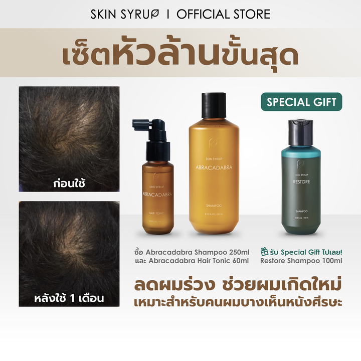 [NICKY] เซ็ตหัวล้านขั้นสุด