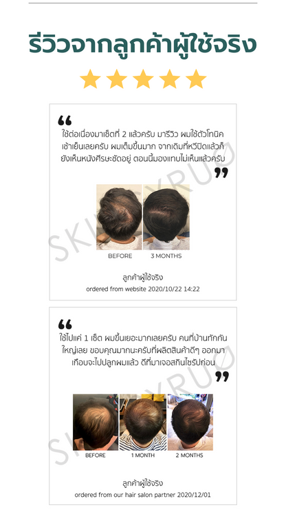 [NEW] PACK ABRACADABRA Anti-Hair Fall SHAMPOO & CONDITIONER แชมพูและครีมนวดฟื้นบำรุงลดผมร่วง ช่วยผมเกิดใหม่ +214%